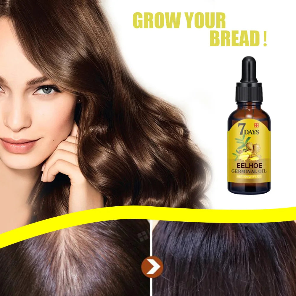 EELHOE Ginger Hair Growth Oil - Mrmora